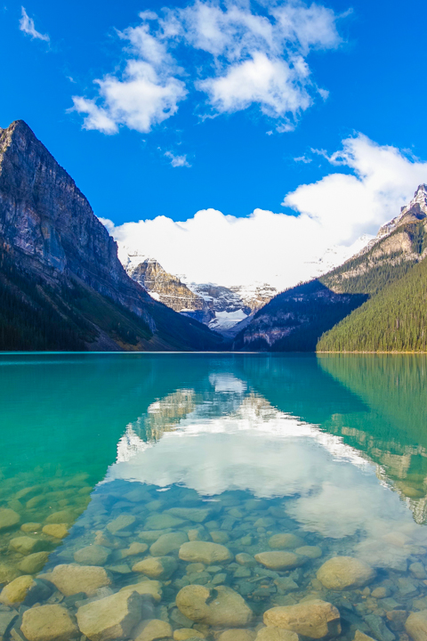 Breathtaking Lake Louise — Kevin & Amanda